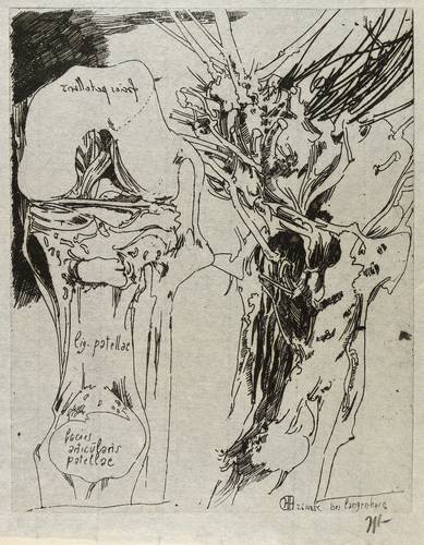 Janssen, Horst -  -  - Facies articularis patellae (Kniegelenk und Baumstumpf)