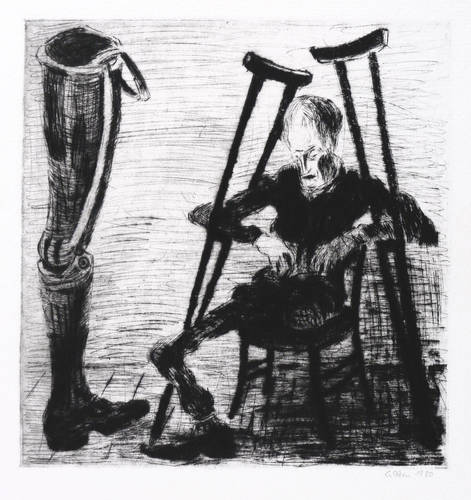 Hein, Günter -  -  - Die Prothese (Einbeiniger)